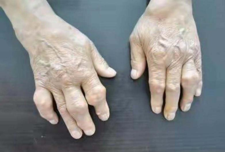6376610631540100009107944.png
