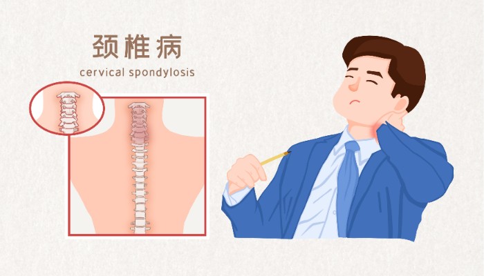摄图网_401799963_颈椎病医疗插画（非企业商用）.jpg