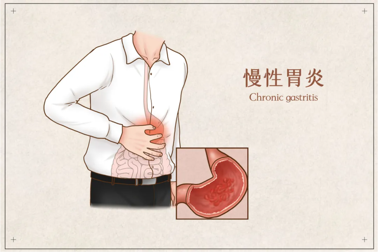 d5f95a1a3a6e8897936626390c4b3a0.png