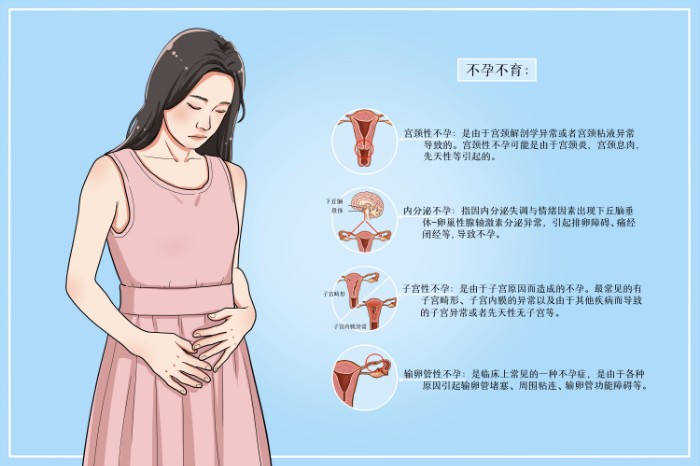 摄图网_401961514_女性不孕不育医疗插画(非企业商用).jpg